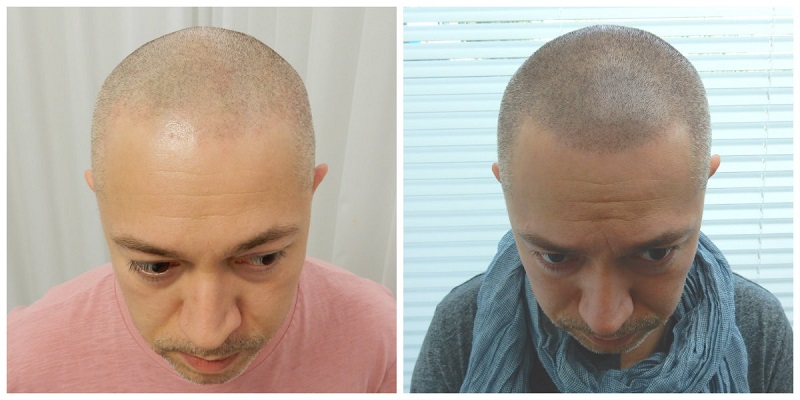 Perfecte dichtheid bij shaven look