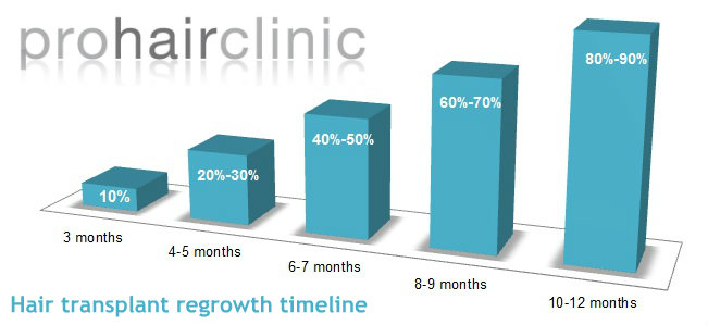 timeline hair transplantation